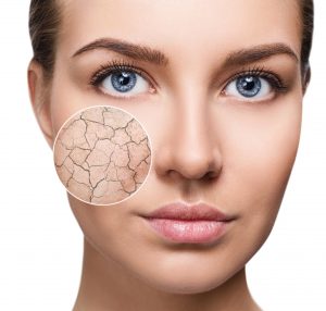 20 Reasons Why Your Face Is Dry - The Dermatology Review